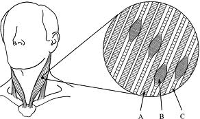 trigger point trigger point